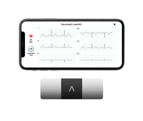 AliveCor KardiaMobile 6-Lead Personal EKG Monitor – Six...